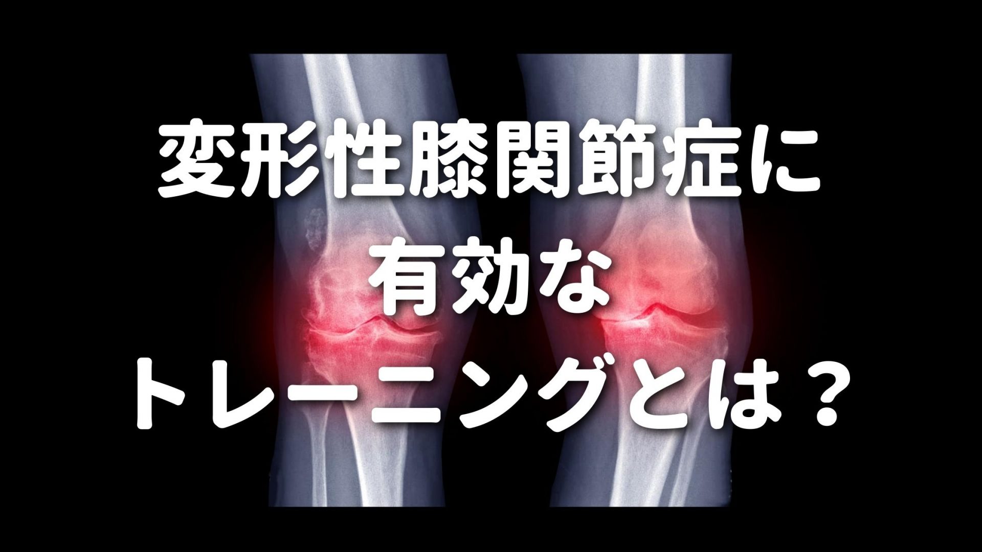 変形性膝関節症に有効なトレーニングとは？